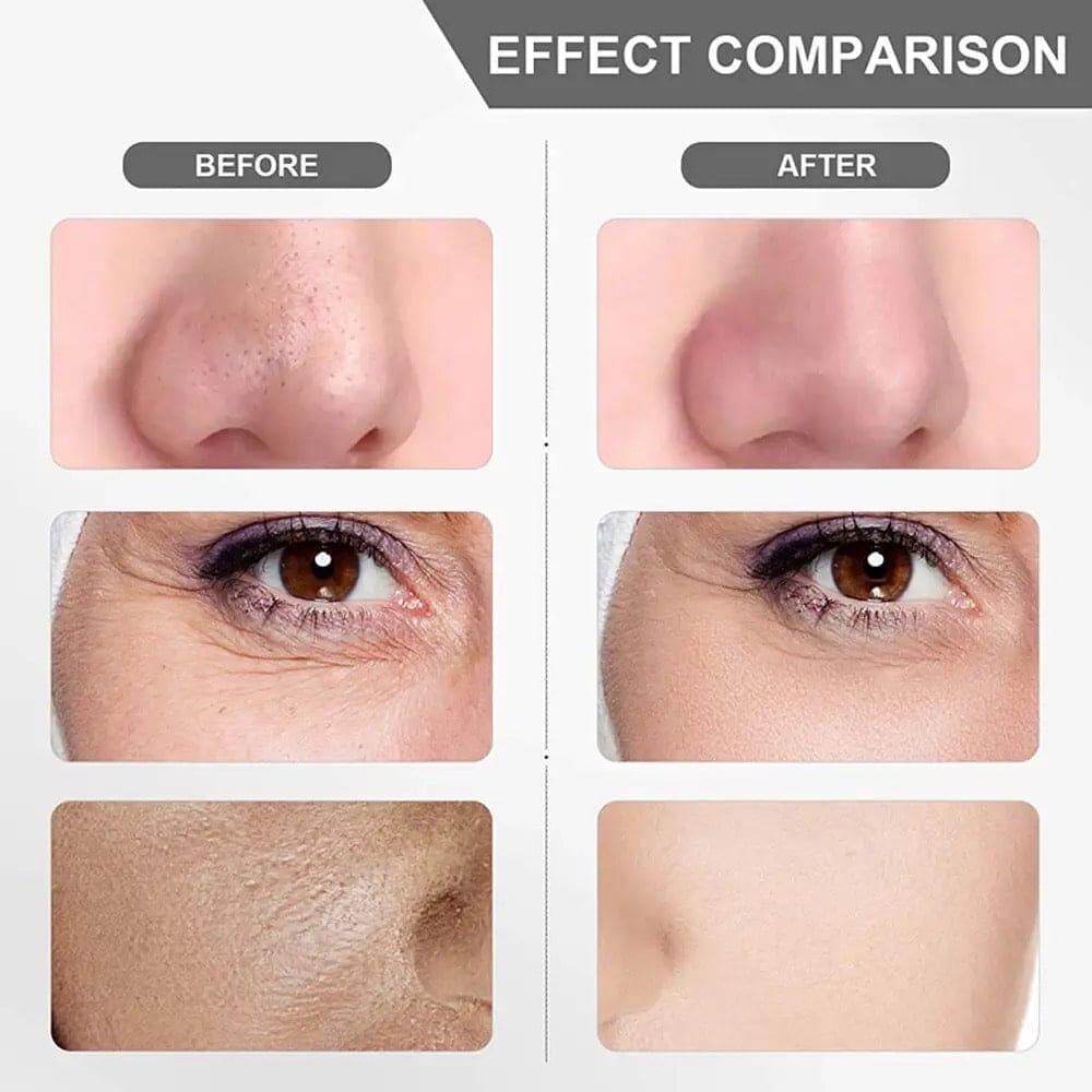 Ultrasonic Facial Skin Scrubber – Deep Cleanse & Glowing Skin in Minutes!