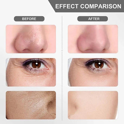 Ultrasonic Facial Skin Scrubber – Deep Cleanse & Glowing Skin in Minutes!